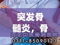 突发骨髓炎,骨髓炎发病的主要因素