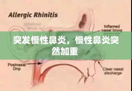 突发慢性鼻炎,慢性鼻炎突然加重